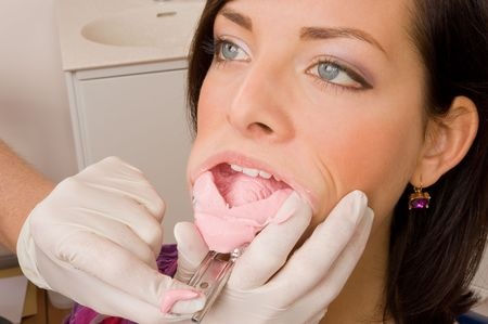 A dentist removes a dental impression from a patient's mouth